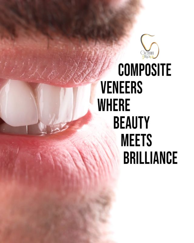 We don't just create veneers; we create perfect, natural smiles.  نحن لا نقوم فقط بإنشاء قشور الأسنان؛ بل نصنع أيضًا ابتسامات طبيعية مثالية.