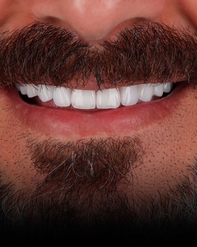 Your style and your smile are perfectly in tune. Book your appointment to have truly natural-looking veneers.  مظهرك وابتسامتك متناسقان تمامًا. تواصل معنا للحصول على قشور أسنان طبيعية المظهر.